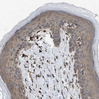 Immunohistochemical staining of human skin shows moderate cytoplasmic positivity in squamous epithelial cells.