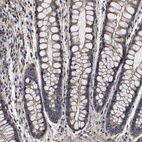 Immunohistochemical staining of human colon shows moderate cytoplasmic positivity in myocytes.