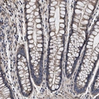 Immunohistochemical staining of human colon shows moderate cytoplasmic positivity in myocytes.