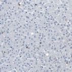 Immunohistochemical staining of human liver shows no positivity in hepatocytes as expected.