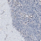 Anti-HTR1A Antibody