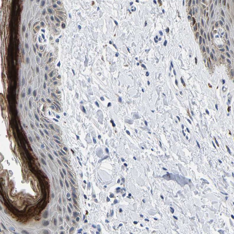 Anti-C14orf177 Antibody
