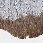 Anti-PLPP6 Antibody