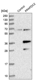 Anti-PLPP6 Antibody