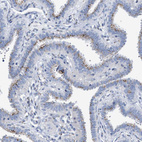 Anti-TMEM17 Antibody