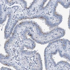 Anti-TMEM17 Antibody