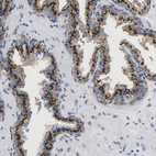 Immunohistochemical staining of human prostate shows strong cytoplasmic granular positivity in glandular cells.