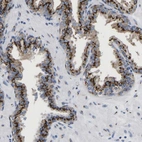Immunohistochemical staining of human prostate shows strong cytoplasmic granular positivity in glandular cells.