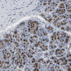 Immunohistochemical staining of human pancreas shows strong cytoplasmic granular positivity in exocrine glandular cells.