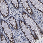 Immunohistochemical staining of human colon shows strong cytoplasmic granular positivity in glandular cells.