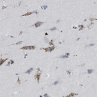 Immunohistochemical staining of human cerebral cortex shows strong cytoplasmic granular positivity in neurons.