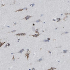 Immunohistochemical staining of human cerebral cortex shows strong cytoplasmic granular positivity in neurons.