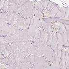 Immunohistochemical staining of human skeletal muscle shows low expression as expected.