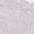 Anti-MCOLN3 Antibody