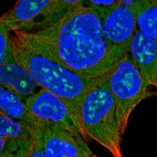 Immunofluorescent staining of human cell line HEK 293 shows localization to nucleoli & cytosol.