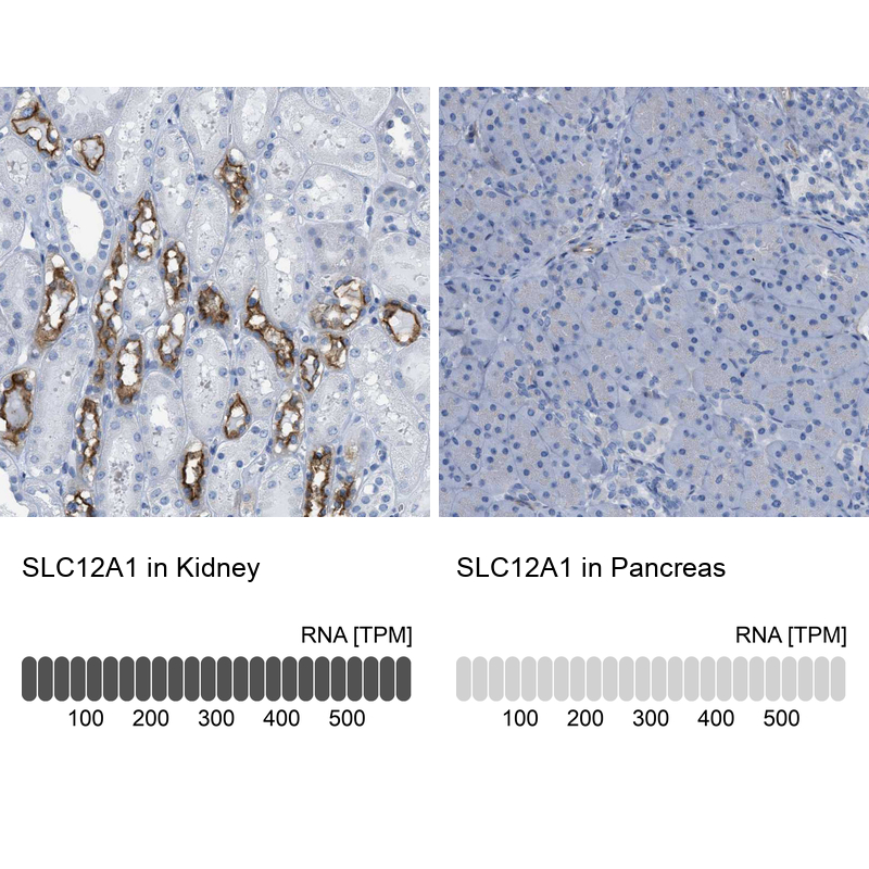 Anti-SLC12A1 Antibody