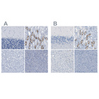 Immunohistochemical staining of human cerebellum, kidney, liver and pancreas using Anti-SLC12A1 antibody HPA018107 (A) shows similar protein distribution across tissues to independent antibody HPA014967 (B).