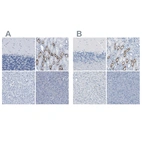 Immunohistochemical staining of human cerebellum, kidney, liver and pancreas using Anti-SLC12A1 antibody HPA018107 (A) shows similar protein distribution across tissues to independent antibody HPA014967 (B).