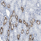 Immunohistochemical staining of human kidney shows strong membranous positivity in cells in tubules.