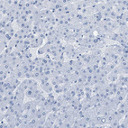 Immunohistochemical staining of human liver shows no positivity in hepatocytes as expected.