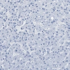 Immunohistochemical staining of human liver shows no positivity in hepatocytes as expected.