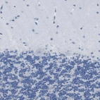 Immunohistochemical staining of human cerebellum shows no positivity in Purkinje cells as expected.