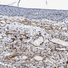 Immunohistochemical staining of human skin shows moderate to strong positivity in extracellular matrix in stroma.