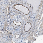 Immunohistochemical staining of human fallopian tube shows moderate to strong positivity in blood vessels.