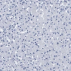 Immunohistochemical staining of human liver shows no positivity in hepatocytes as expected.