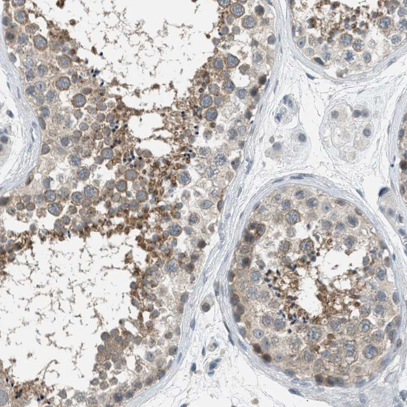 Anti-TTBK2 Antibody