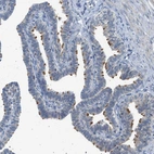 Immunohistochemical staining of human Fallopian tube shows strong positivity in cilia in glandular cells.