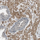 Immunohistochemical staining of human prostate shows moderate cytoplasmic positivity in smooth muscle cells.