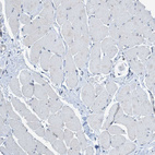 Immunohistochemical staining of human skeletal muscle shows very weak positivity in myocytes.