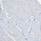Immunohistochemical staining of human skeletal muscle shows very weak positivity in myocytes.