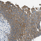 Anti-TWF1 Antibody