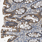 Immunohistochemical staining of human colon shows moderate cytoplasmic positivity in glandular cells.