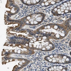 Immunohistochemical staining of human colon shows moderate cytoplasmic positivity in glandular cells.