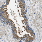Immunohistochemical staining of human prostate shows moderate cytoplasmic positivity in glandular cells.