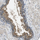 Immunohistochemical staining of human prostate shows moderate cytoplasmic positivity in glandular cells.