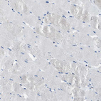 Immunohistochemical staining of human skeletal muscle shows no positivity in myocytes as expected.