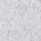 Immunohistochemical staining of human skeletal muscle shows no positivity in myocytes as expected.