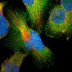 Immunofluorescent staining of human cell line U-251 MG shows localization to cytosol.