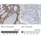 Anti-BAG1 Antibody