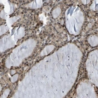 Immunohistochemical staining of human thyroid gland shows high expression.