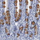 Immunohistochemical staining of human duodenum shows moderate positivity in mucus in glandular cells.