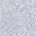 Immunohistochemical staining of human liver shows no positivity in hepatocytes.