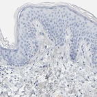 Immunohistochemical staining of human skin shows no positivity in squamous epithelial cells.