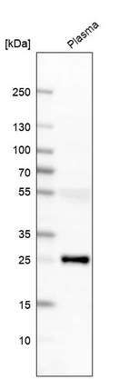 Western blot analysis in human plasma.