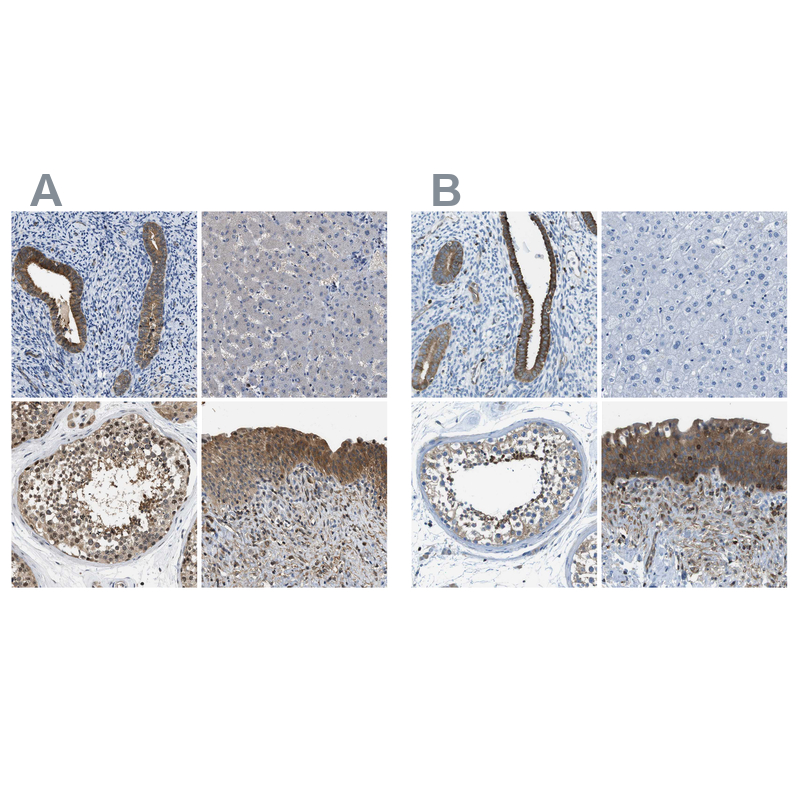 Anti-TES Antibody