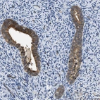 Immunohistochemical staining of human endometrium shows moderate cytoplasmic positivity in glandular cells.